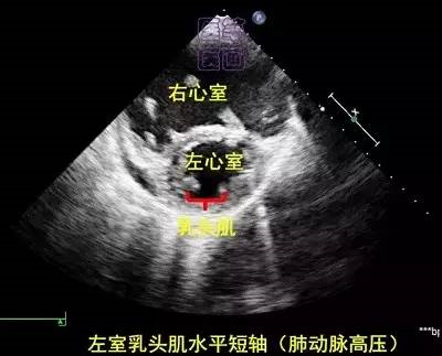 微信图片_20210123093353.png