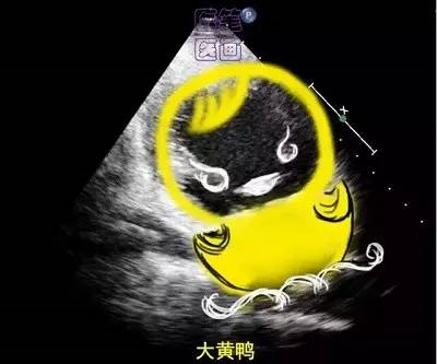 微信图片_20210123093337.png