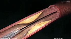 8.gif