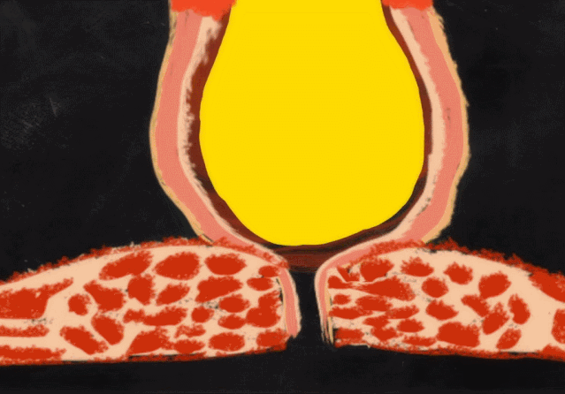 53ddb1ed24ad49909c04a9001f8b612c.gif