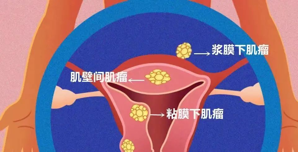 微信图片_20220228111128.png