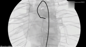 6.gif