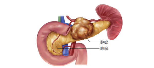 胰腺长什么样图片图片