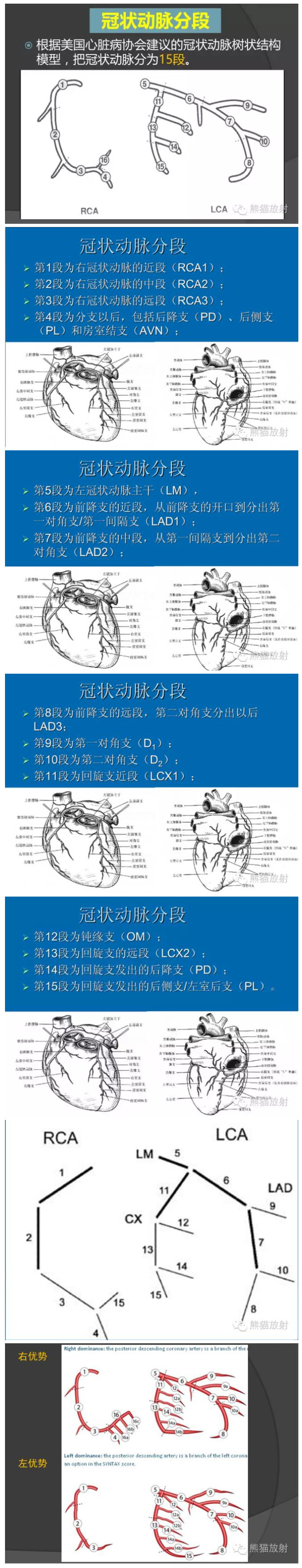 冠脉分段示意图图片