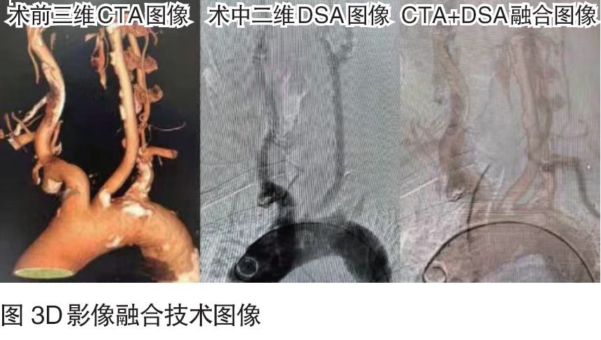 病例图片.png