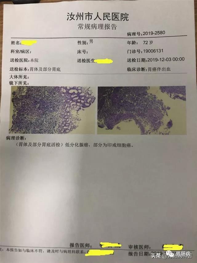 新车怎么挑 老司机教你选车