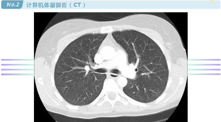 壹生资讯 国际肺癌日 检查手段五花八门该如何抉择 医生手把手教你选择肺癌诊断的最佳手段