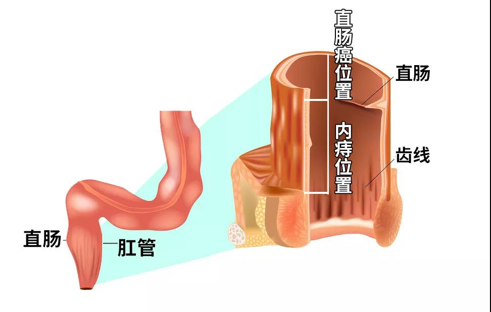 痔疮内部是什么结构图片