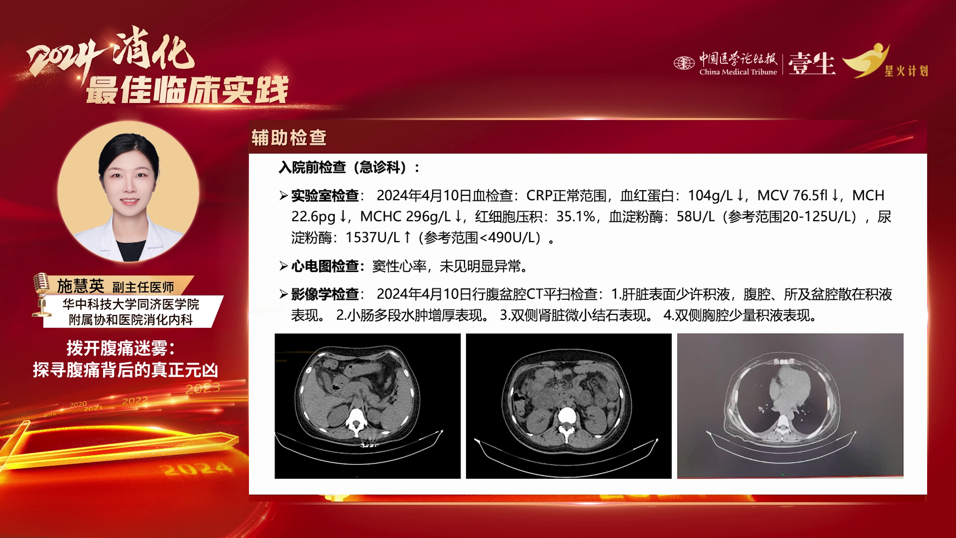 upfile slide_0007.png