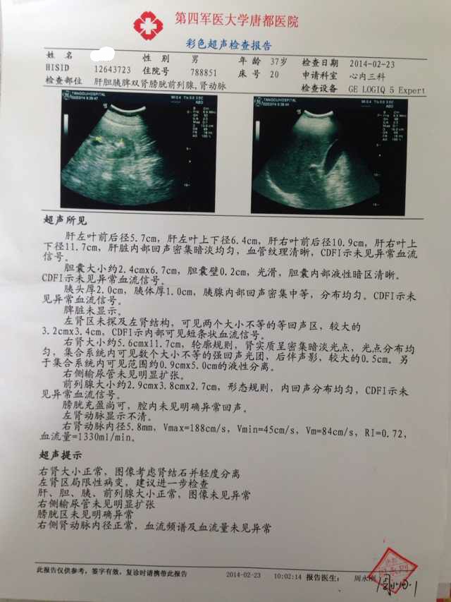 8mmol/l血凝常規:正常血常規:白細胞 11.73*109/l;中性粒百分率 0.