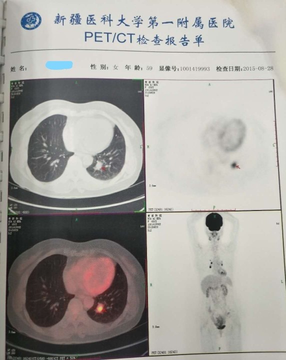 Inked图片10_LI.jpg