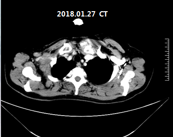 微信截图_20191212105058.png
