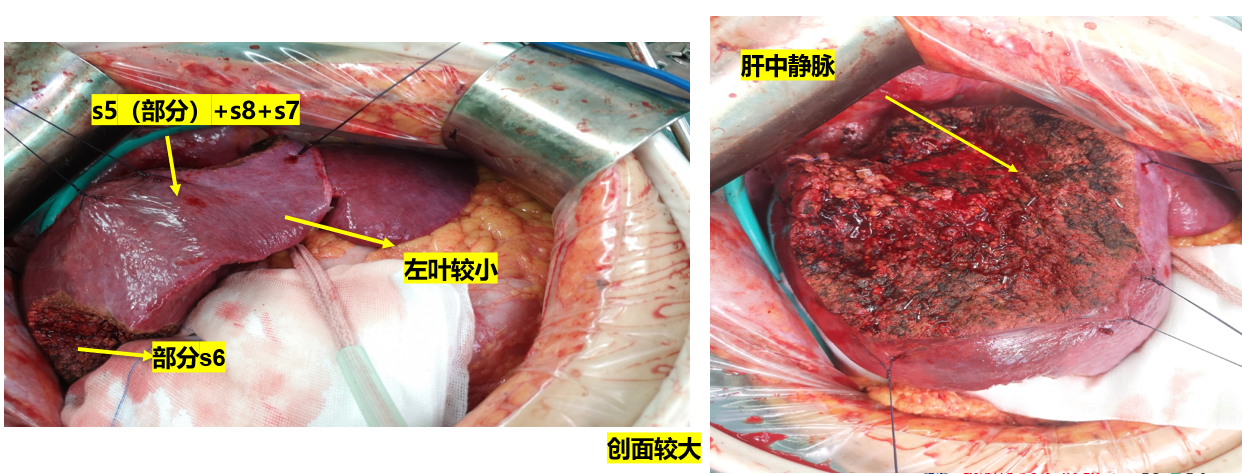 bac55888b441d3b350181f38fa5bcde.png