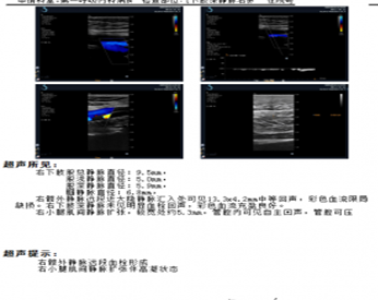 微信截图_20191121134036.png