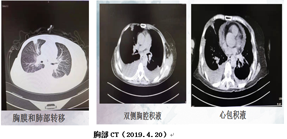 微信截图_20191030161752.png