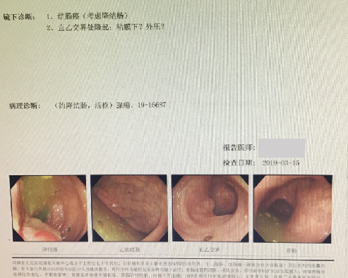 【万例鉴肠程】晚期结直肠癌三线治疗病例——河南省人民院,张昊