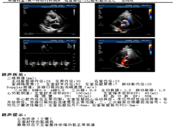 微信截图_20191121134251.png