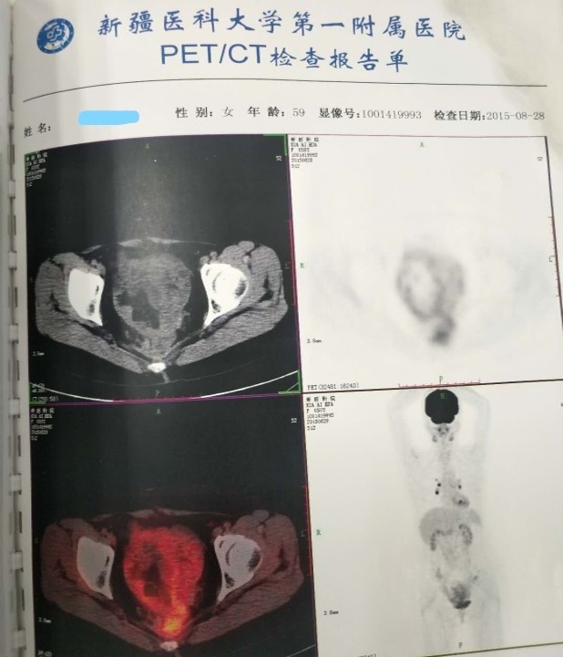 Inked图片9_LI.jpg