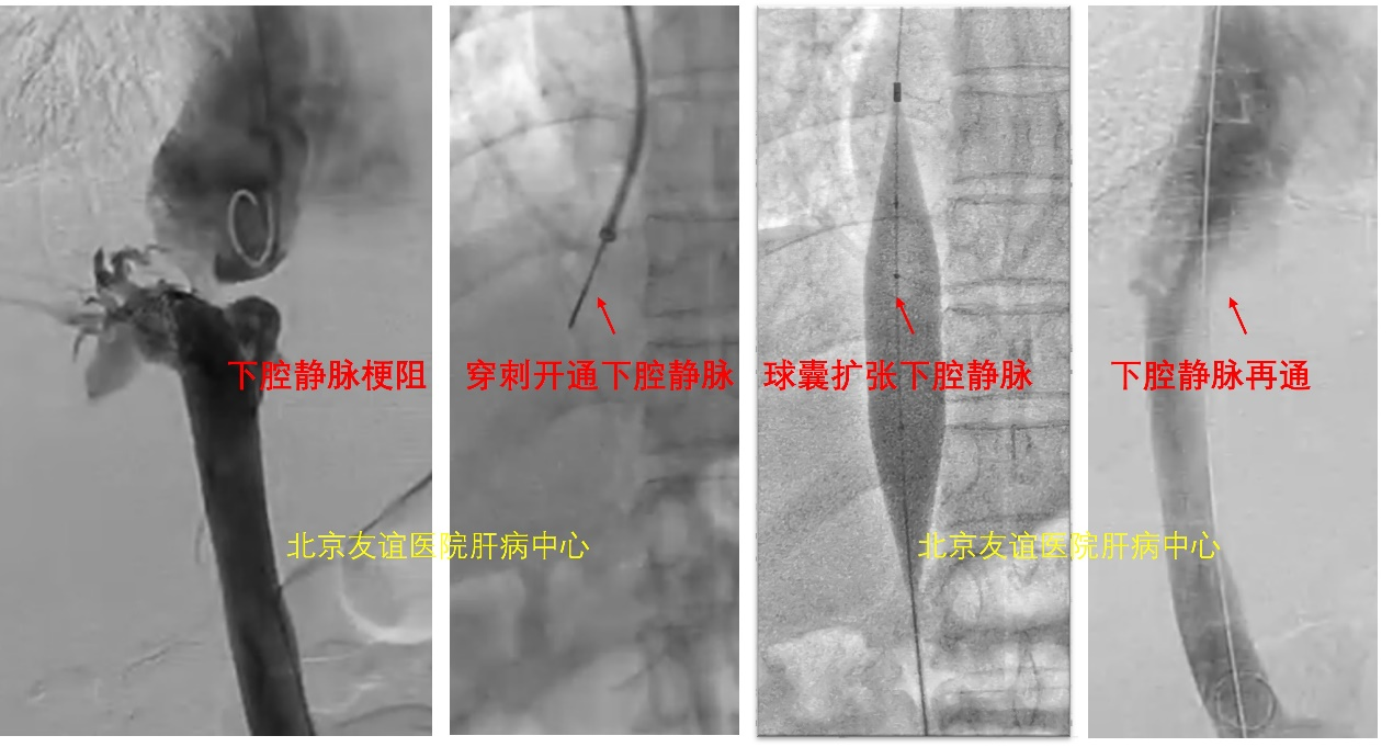 图片42.png