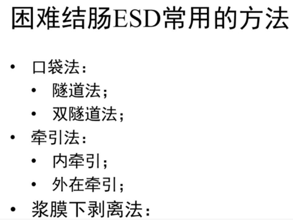 方法.png