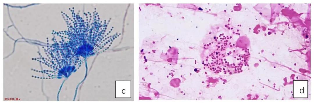 马尔尼菲蓝状菌图图片
