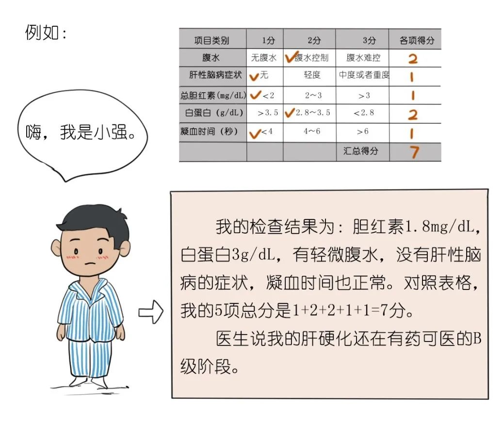 于b级；总分超过10分属于c级。肝硬化c级最严重，患者平均只能存活1～3年。