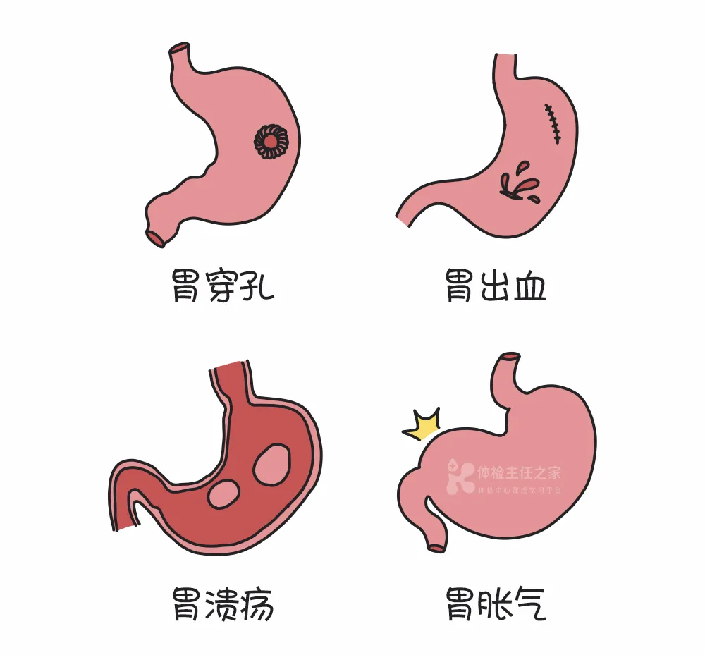 知名演员因胃癌去世从确诊到离世仅3个月│这几类人群建议查胃镜