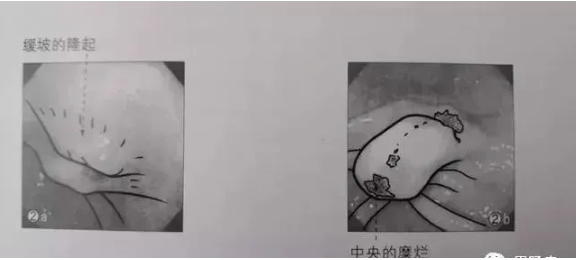 微信截图_20200530144104.png