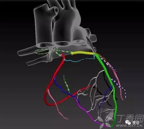 淡蓝色(右室前壁上部动脉圆锥和前降支发出的动脉圆锥支)绿白相间 