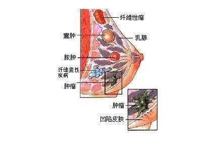 甲1.jpg