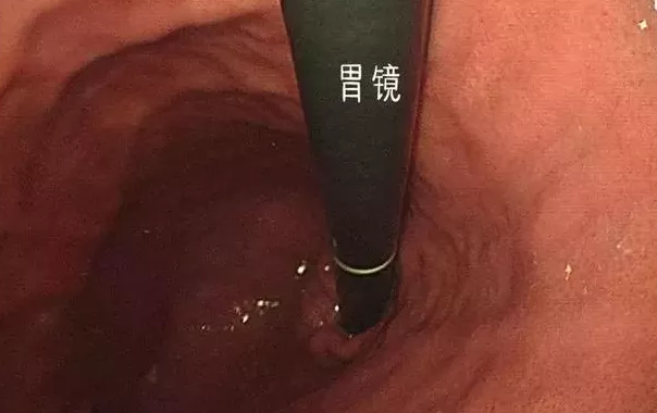 微信截图_20200618172721.png