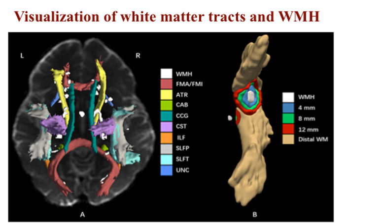 wmh11.png