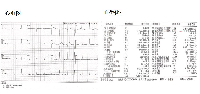 捕获1.png