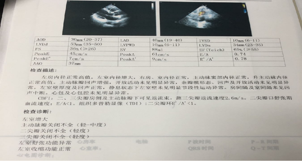冠脉cta报告图片