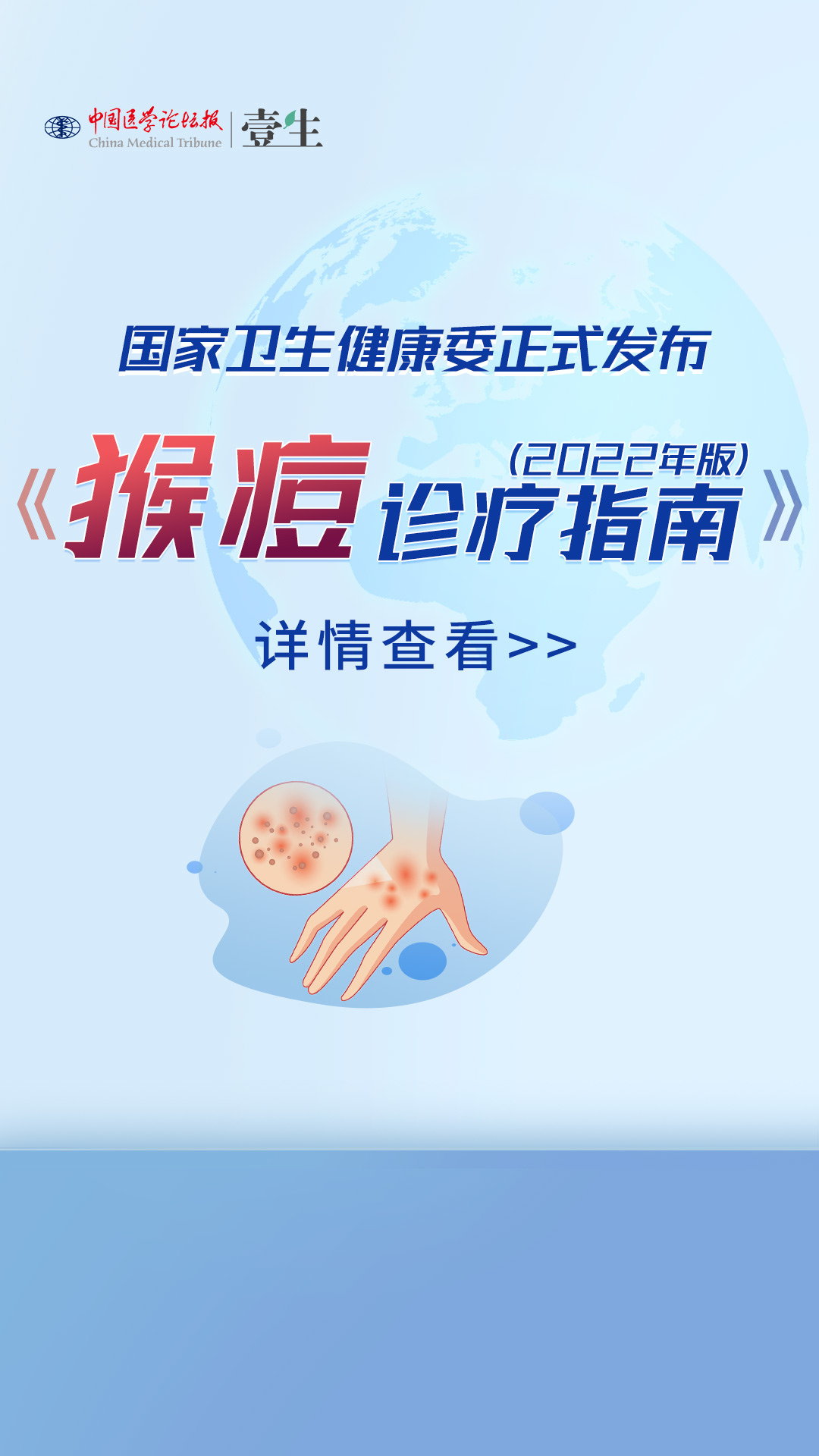 猴痘指南.jpg