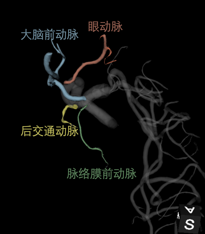 颈内动脉体表投影图片