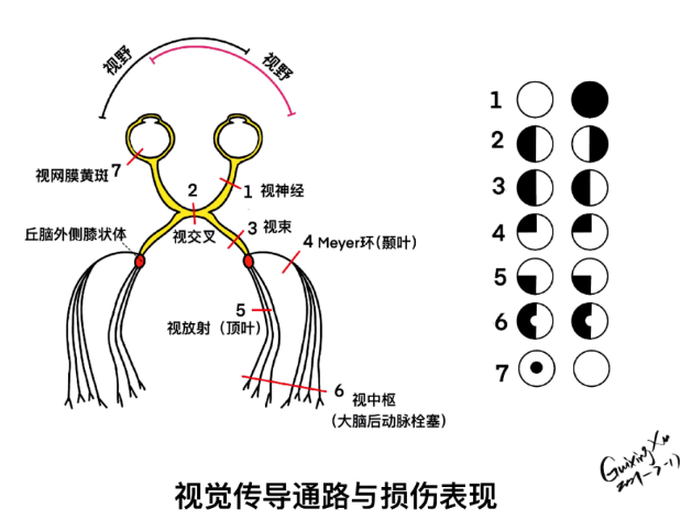 视觉传导通路与损伤表现视觉传导通路ii —— 视神经人的情绪有 75%