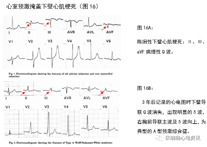 微信图片_20210622100945.png