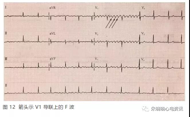 微信图片_20201217154106.jpg