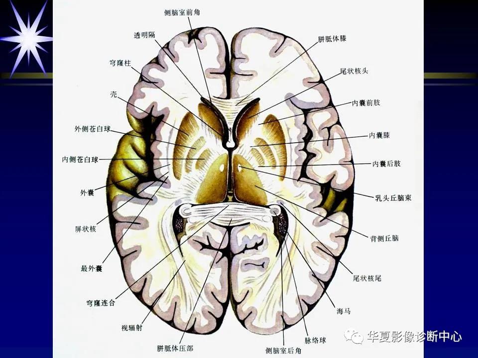 端脑图片