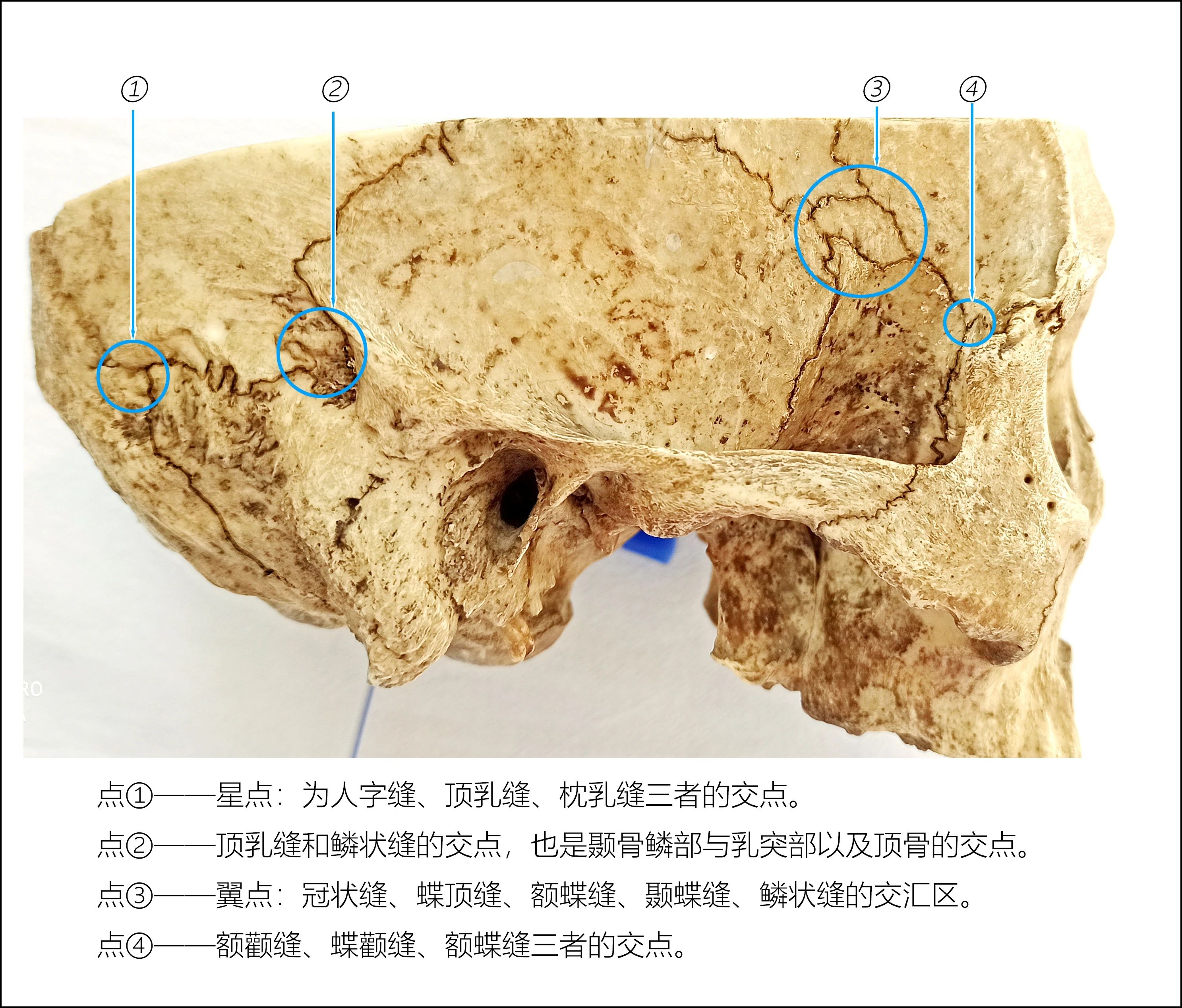 颅缝解剖图谱图片