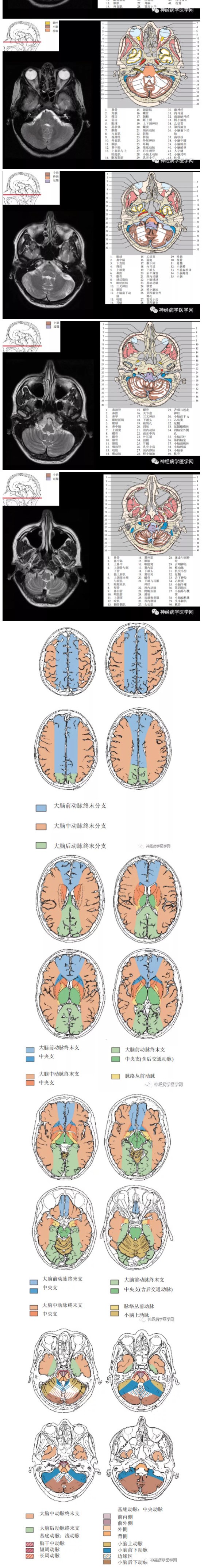 脑CT3.2.jpg