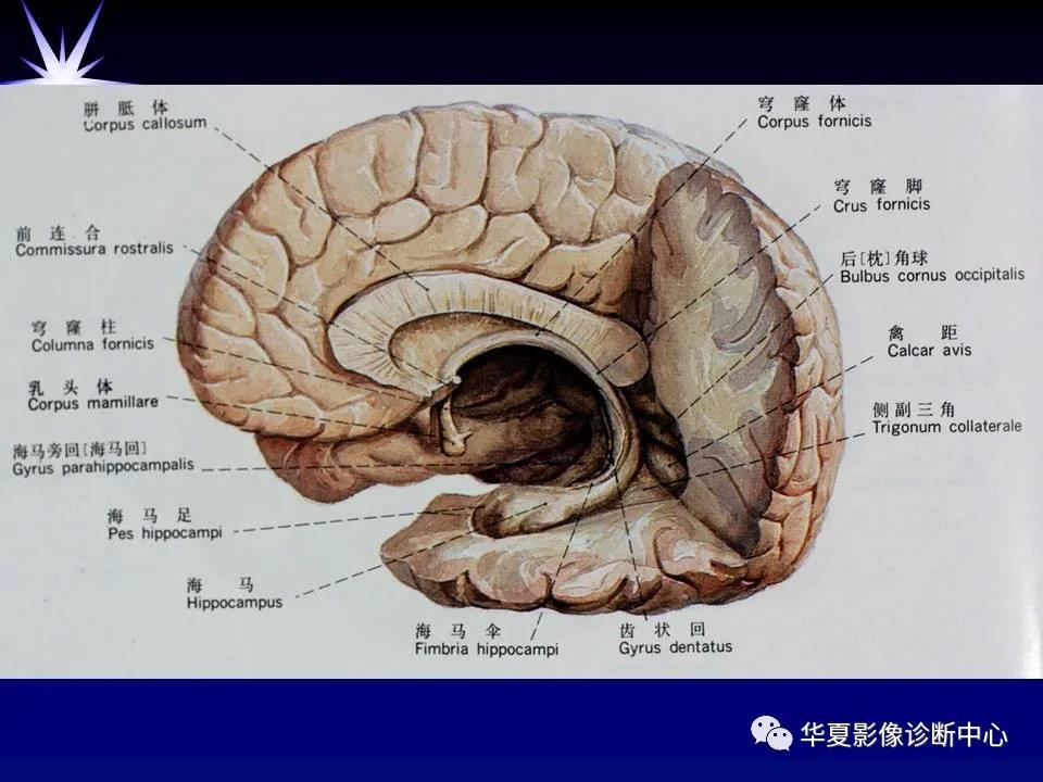 端脑图片