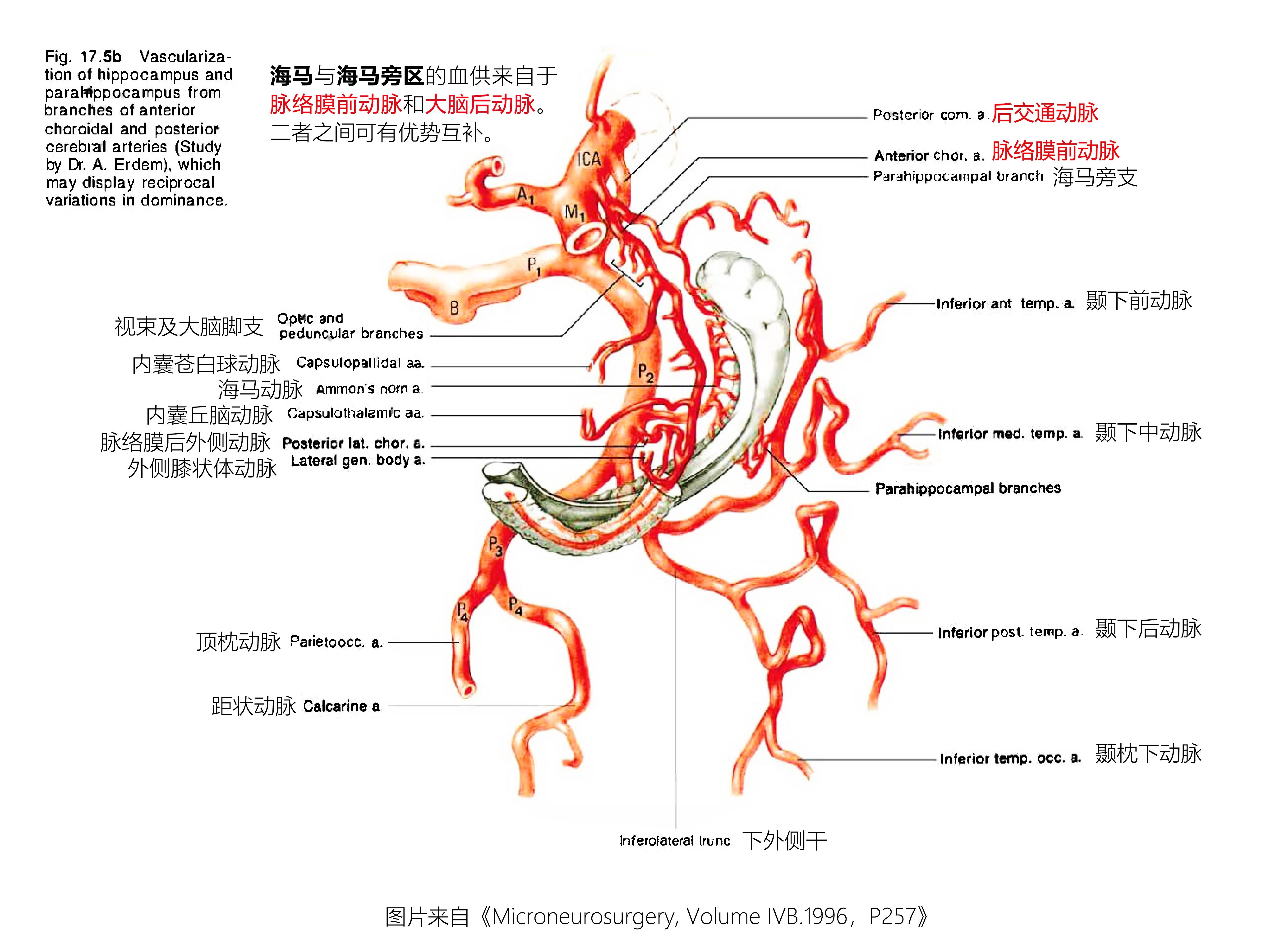 脉络膜动脉图片