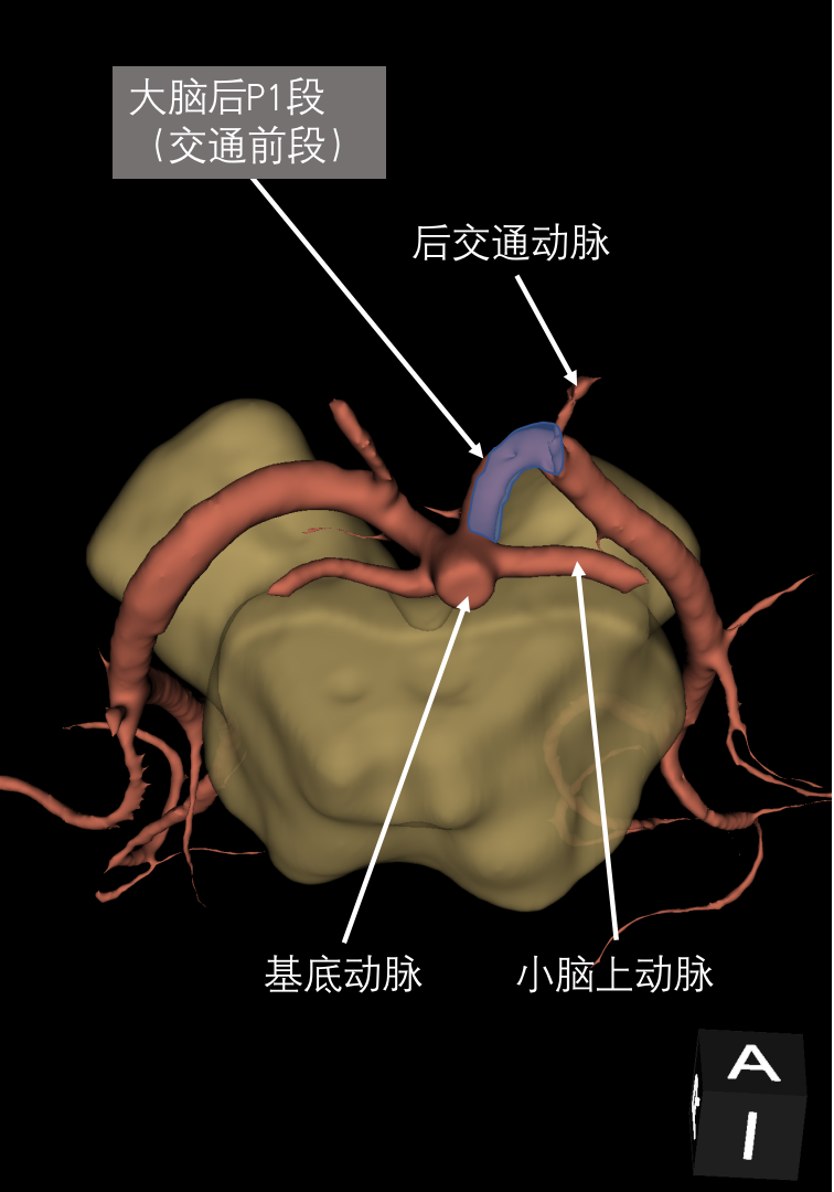 大脑后动脉影像解剖展示