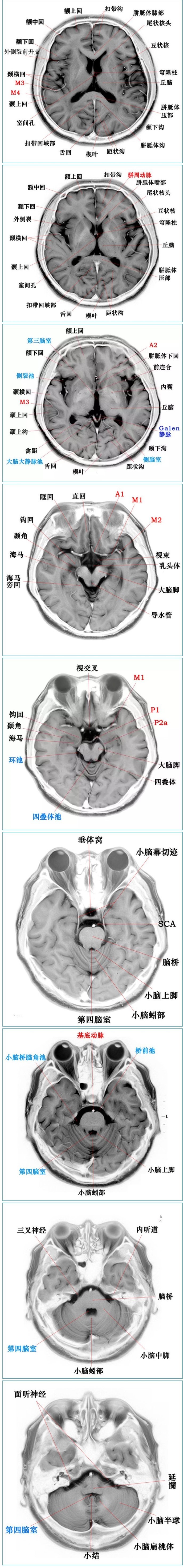 3.0T-T2WI反相图学颅脑断层解剖1.2.jpg