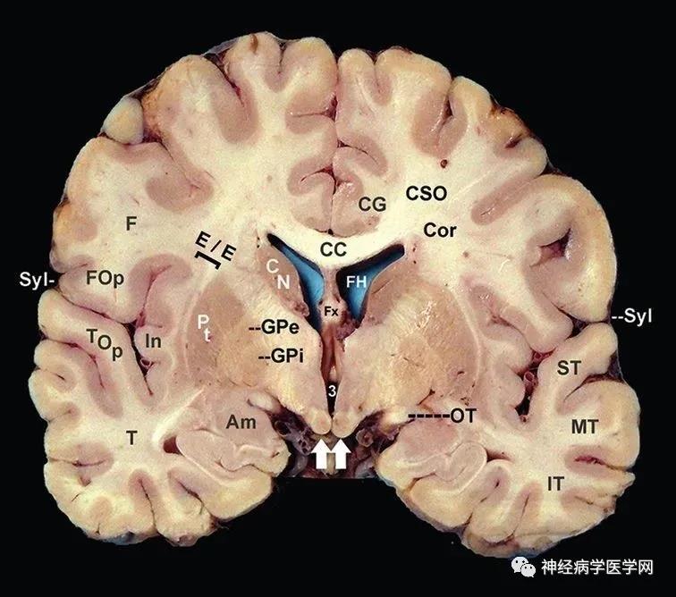 神經解剖:病損表現及定位診斷®醫學論壇網-網聚醫學的力量