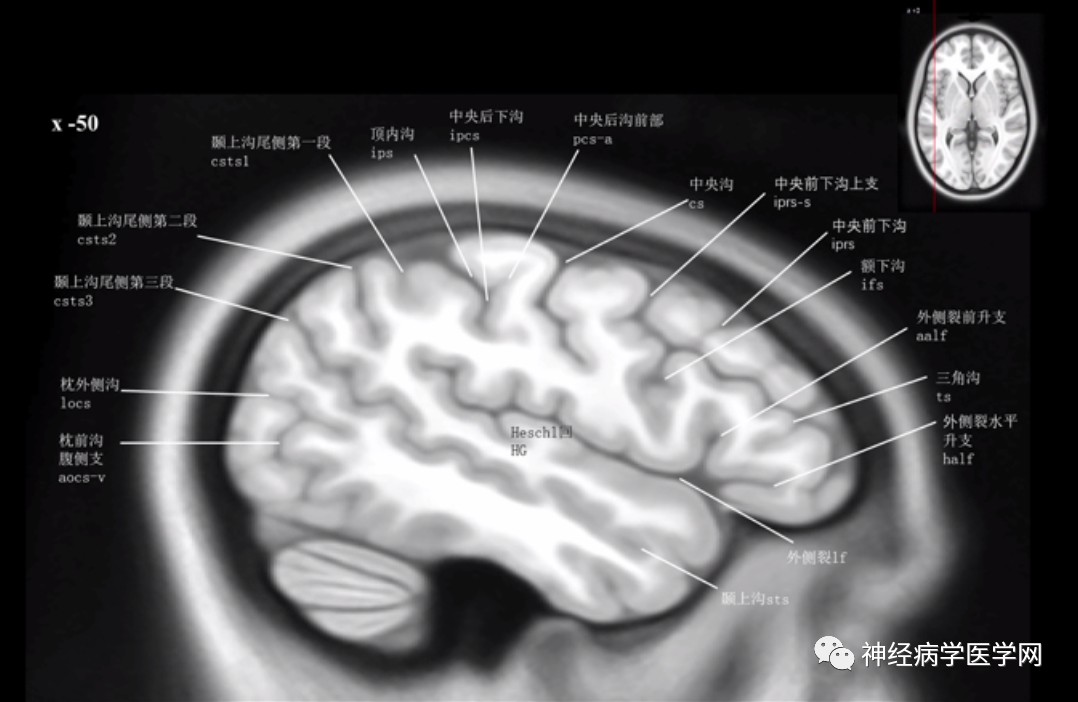 大脑中央沟体表定位图片
