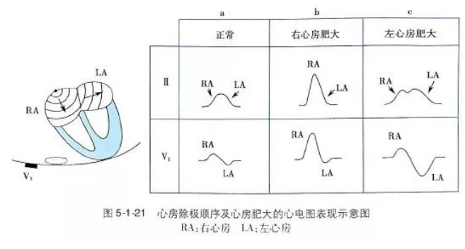 心電圖總是記不住?這些基礎知識一定要掌握!