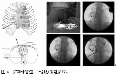 微信图片_20220303151234.png